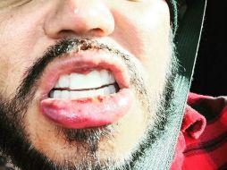 El fundador de Kumbia Kings subió una fotografía a Instagram donde se le ve con una dentadura provisional. INSTAGRAM / @abquintanilla3