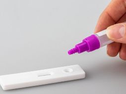 Pruebas. Las pruebas para detección de Covid están en escasez. Pixabay