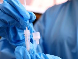 El Western New York Urology Associates indica que la meningitis se caracteriza por la inflamación del recubrimiento del cerebro (llamado meninges). AFP / ARCHIVO