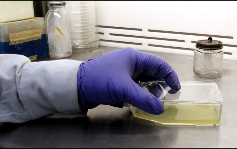 La meningitis es considerada una de las enfermedades más peligrosas en la infancia. NTX / ARCHIVO