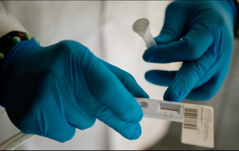 Decidieron enviar muestras al Centro para el Control y Prevención de Enfermedades de Estados Unidos. EL INFORMADOR/ARCHIVO