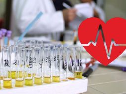 Estas son las señales de esta afectación que es provocada por diversas causas. EL INFORMADOR / ARCHIVO