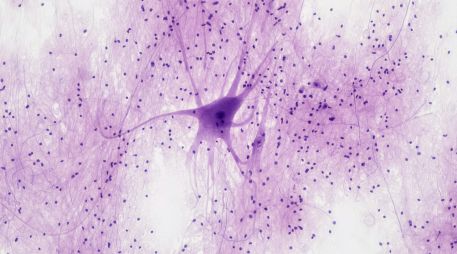 Compararon esferoides neuronales generados a partir de pacientes con diferentes tipos de alzheimer. UNSPLASH / BILFR