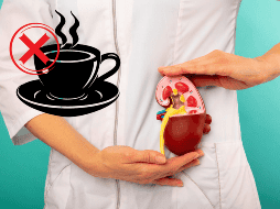 El café tiene propiedades diuréticas, lo que puede incrementar la frecuencia de la micción y llevar a una mayor eliminación de líquidos del cuerpo.  CANVA