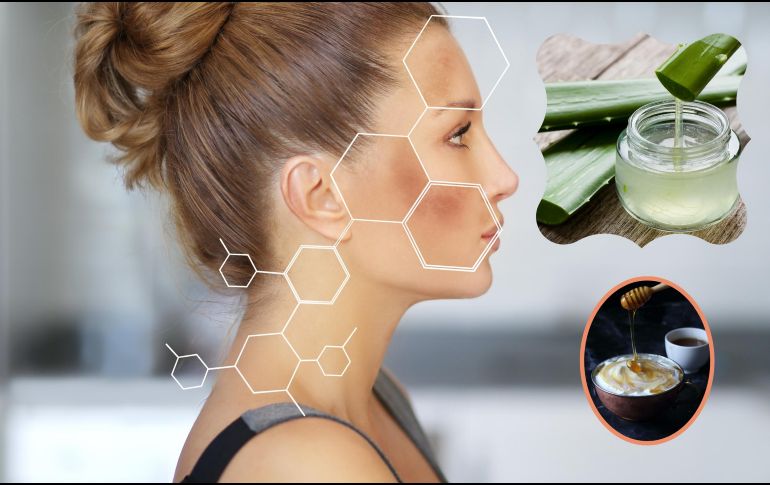 Existen remedios naturales que te pueden ayudar a reducir las manchas y mantener la salud de la piel. ESPECIAL / CANVA