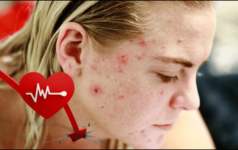 Es importante es llevar una alimentación balanceada con minerales y vitaminas. PEXELS / CANVA