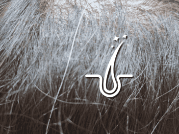 Las canas, desde luego, son más visibles en las personas que tienen el cabello oscuro, pero no por ello son más propensas de tener cabellos blancos. EL INFORMADOR / O. Álvarez