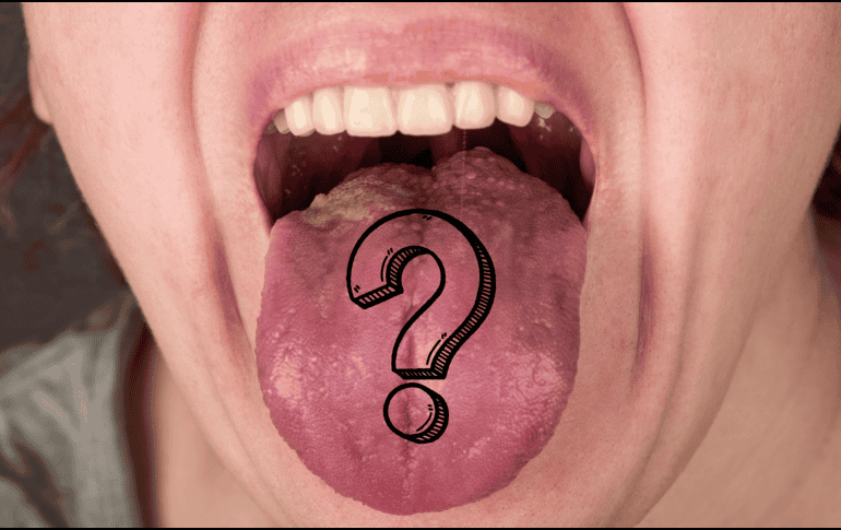 Si persiste o se acompaña de otros síntomas, es recomendable acudir a un profesional de la salud para descartar condiciones más serias.  CANVA