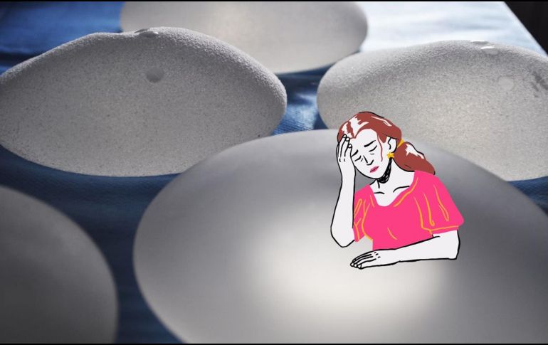 La enfermedad por implantes mamarios aún no tiene un diagnóstico oficial. UNSPLASH / P. SPITALIER