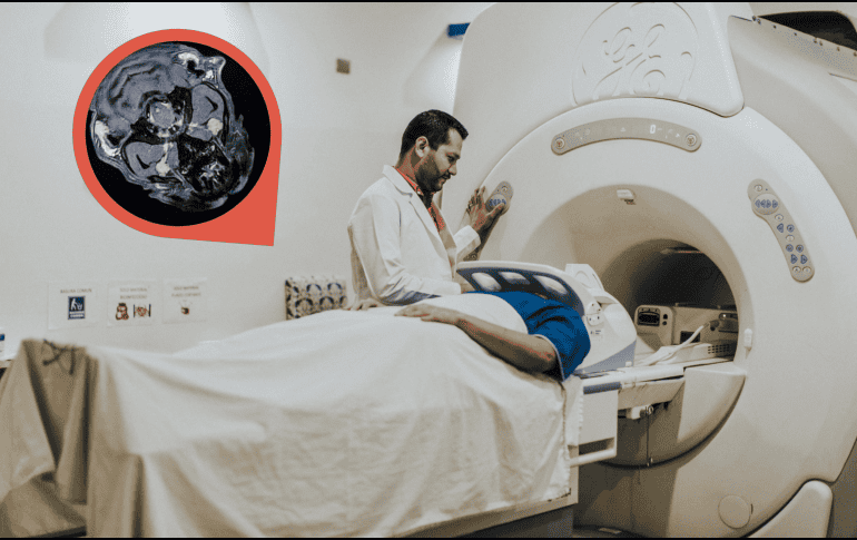 Como medida preventiva, los autores del estudio sugieren evitar ciertos suplementos antes de una resonancia magnética con contraste.  CANVA