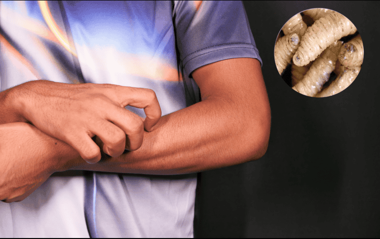 El primer caso humano fue confirmado el pasado 6 de febrero en un hombre de 80 años. ESPECIAL