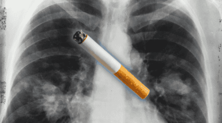 El análisis se basó en 871 muestras de tumores de pulmón de personas no fumadoras residentes en 28 regiones del mundo —incluyendo África, Asia, Europa y América del Norte— con diferentes niveles de contaminación del aire. ESPECIAL / Canva