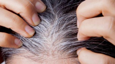 Las canas suelen ser más finas y frágiles, por lo que es esencial reforzar la hidratación del cabello. Pixabay