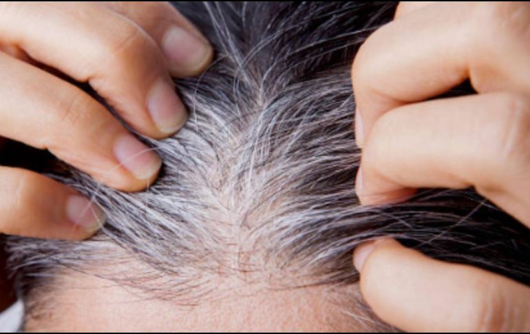 Las canas suelen ser más finas y frágiles, por lo que es esencial reforzar la hidratación del cabello. Pixabay