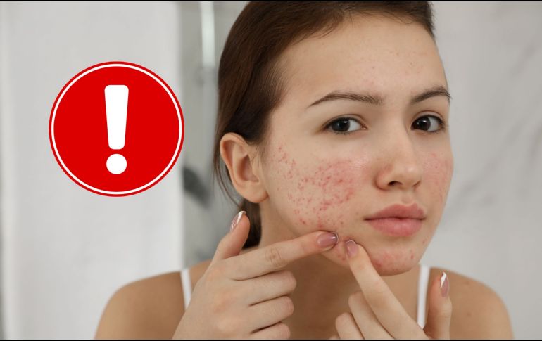 Aunque para muchos pueda parecer exagerado, la recomendación médica es clara: no manipular las lesiones cutáneas en la zona que conecta directamente con el cerebro. CANVA