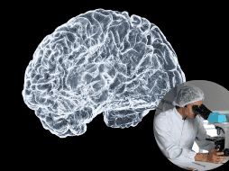 Científicos explican qué causa la enfermedad de párkinson. UNSPLASH / S. DAY / L. VASQUES