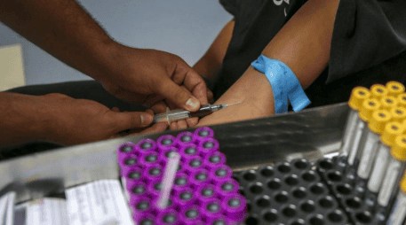 El examen de antígeno prostático específico (PSA) es una prueba de sangre que mide una proteína producida por la próstata y ayuda a detectar cáncer, hiperplasia benigna o prostatitis.CORTESÍA / HCG