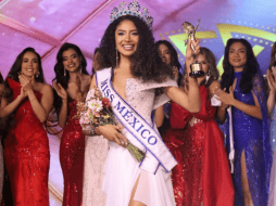 Su causa resulta ideal para el concurso, ya que el certamen de Miss Mundo está más enfocado en la 