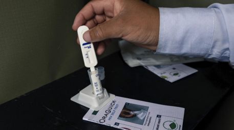 Datos de las autoridades de salud muestran que durante el año 2024 se notificaron 940 nuevos casos de VIH en Costa Rica. ESPECIAL / AFP