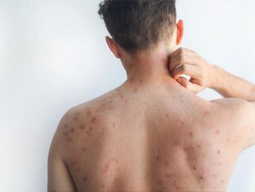 De acuerdo con la Organización Mundial de la Salud (OMS), hay algunas acciones que puedes realizar para mejorar algunos síntomas. ESPECIAL/Canva