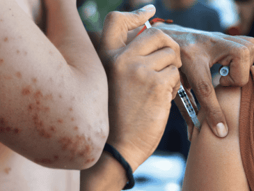 México superó esta semana los 10 mil casos de sarampión confirmados desde enero del año pasado. EL INFORMADOR/ARCHIVO ESPECIAL/Canva