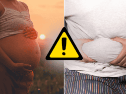 El sobrepeso y la obesidad se asociaron de forma independiente con un mayor riesgo de que los hijos acabaran sufriendo MASLD. CANVA/ESPECIAL