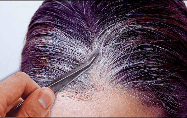 Arrancar las canas con los dedos o pinzas puede provocar pérdida anormal de cabello, también conocida como alopecia. ESPECIAL / CANVA