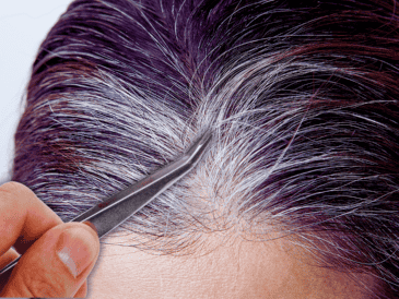 Arrancar las canas con los dedos o pinzas puede provocar pérdida anormal de cabello, también conocida como alopecia. ESPECIAL / CANVA