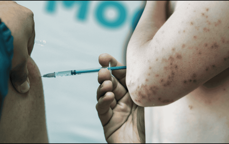 El secretario destacó que las jornadas masivas de vacunación y la implementación del uso de cubrebocas en las escuelas han permitido contener el brote de sarampión. EL INFORMADOR/ARCHIVO ESPECIAL/Canva