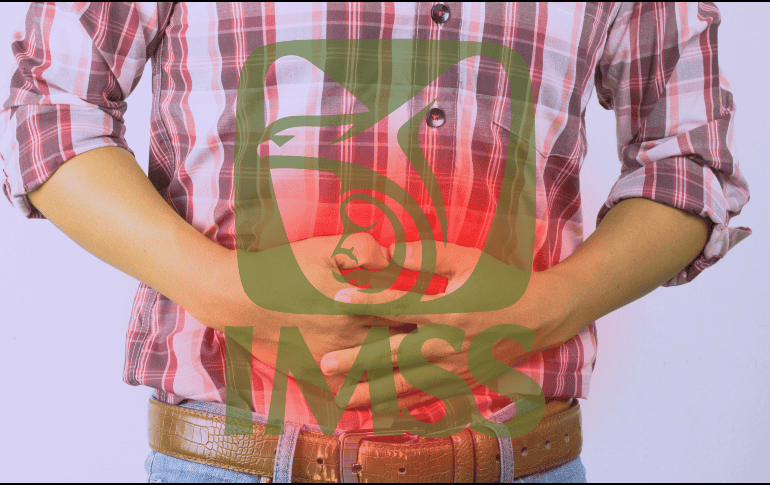 La única forma de curar una apendicitis es a través de un proceso quirúrgico. ESPECIAL