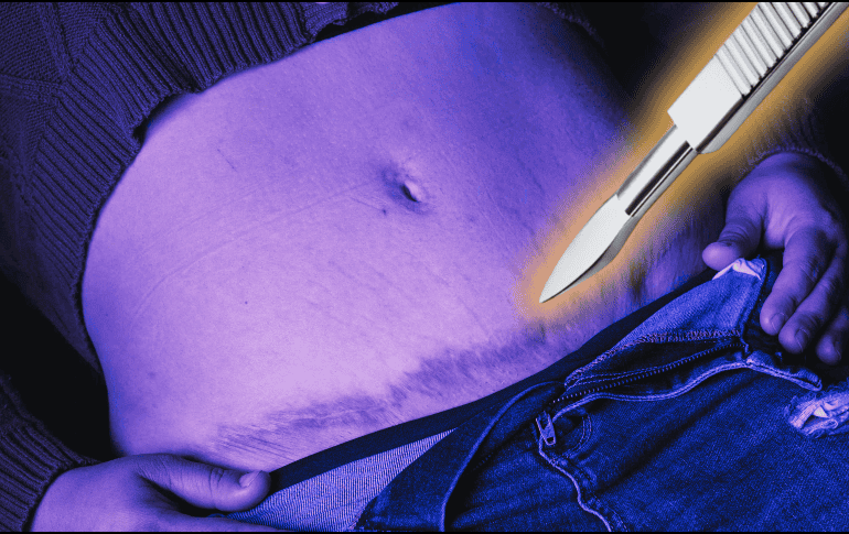 Esta iniciativa se suma a otra que presentada en septiembre de 2025 para prohibir los procedimientos estéticos en menores de edad. SUN/ARCHIVO