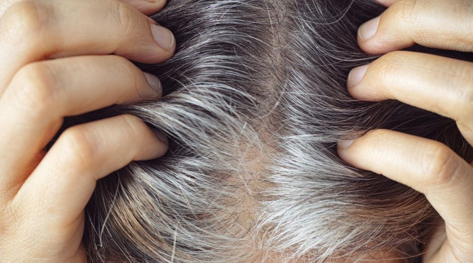 Las canas blancas son las más comunes y aparecen cuando el cabello ha perdido toda la melanina y la acumulación de aire en la fibra capilar. ESPECIAL / CANVA