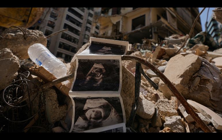 Imágenes de ecografías de un bebé yacenentre los escombros de un edificio destruido que fue alcanzado hace una semana por un bombardeo israelí contra el centro de Beirut, Líbano. AP/H. Malla