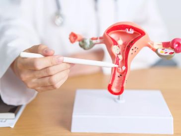 Esta anomalía fisiológica impide que los ovarios liberen óvulos de forma regular y predecible, afectando directamente la fertilidad, la planificación familiar y el ciclo natural del cuerpo femenino. ESPECIAL