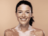 Actualmente no existe una cura definitiva para el vitiligo, pero sí tratamientos que pueden ayudar a controlar la despigmentación o mejorar la apariencia de la piel.  CANVA