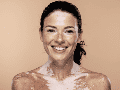 Actualmente no existe una cura definitiva para el vitiligo, pero sí tratamientos que pueden ayudar a controlar la despigmentación o mejorar la apariencia de la piel.  CANVA