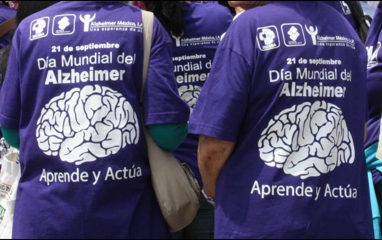 Una investigación analizó cómo la nutrición impacta directamente en la salud cerebral. NTX / ARCHIVO