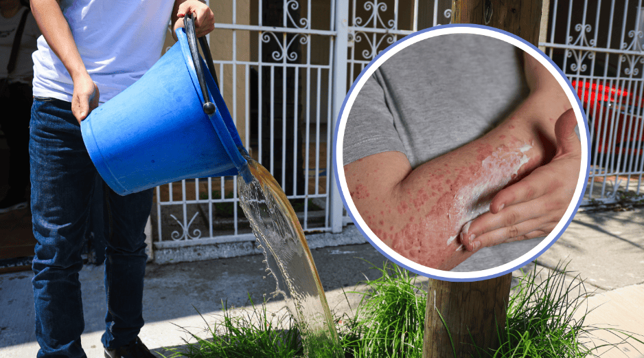 El funcionario cuestionó las evidencias de vecinos y organizaciones, quienes aseguran que tras bañarse y utilizar el agua contaminada que llega a sus viviendas han presentado enfermedades. EL INFORMADOR / ARCHIVO / FREEPIK / CANVA
