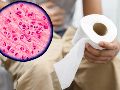 Ante una diarrea acuosa persistente, conviene acudir al médico. ESPECIAL / CANVA