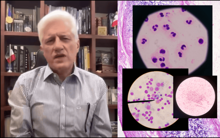 Los CDC informaron que, desde mayo, se han confirmado mil 645 casos de ciclosporiasis en Estados Unidos, cifra que representa un aumento de cuatro veces respecto al mismo periodo de 2025. FACEBOOK/Dr.AlejandroMacias