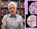 Los CDC informaron que, desde mayo, se han confirmado mil 645 casos de ciclosporiasis en Estados Unidos, cifra que representa un aumento de cuatro veces respecto al mismo periodo de 2025. FACEBOOK/Dr.AlejandroMacias