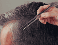 La extracción mecánica y repetida puede inflamar de manera severa esta delicada estructura anatómica, alterando su funcionamiento normal. ESPECIAL / CANVA