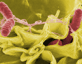 Los Centros para el Control y la Prevención de Enfermedades (CDC) estiman que cada año se reportan entre 150 y 200 infecciones por Vibrio vulnificus en Estados Unidos. CANVA