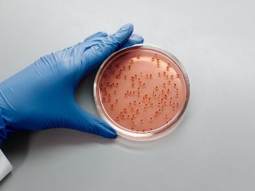 La cyclospora es un parásito microscópico que comúnmente causa diarrea y cuyos brotes ocurren a finales de la primavera y durante el verano. ESPECIAL/PEXELS